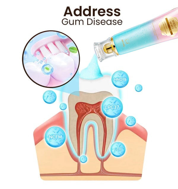 🔥[Official Brand Store] ODALIT™ Niacinamide Intensive Whitening Toothpaste