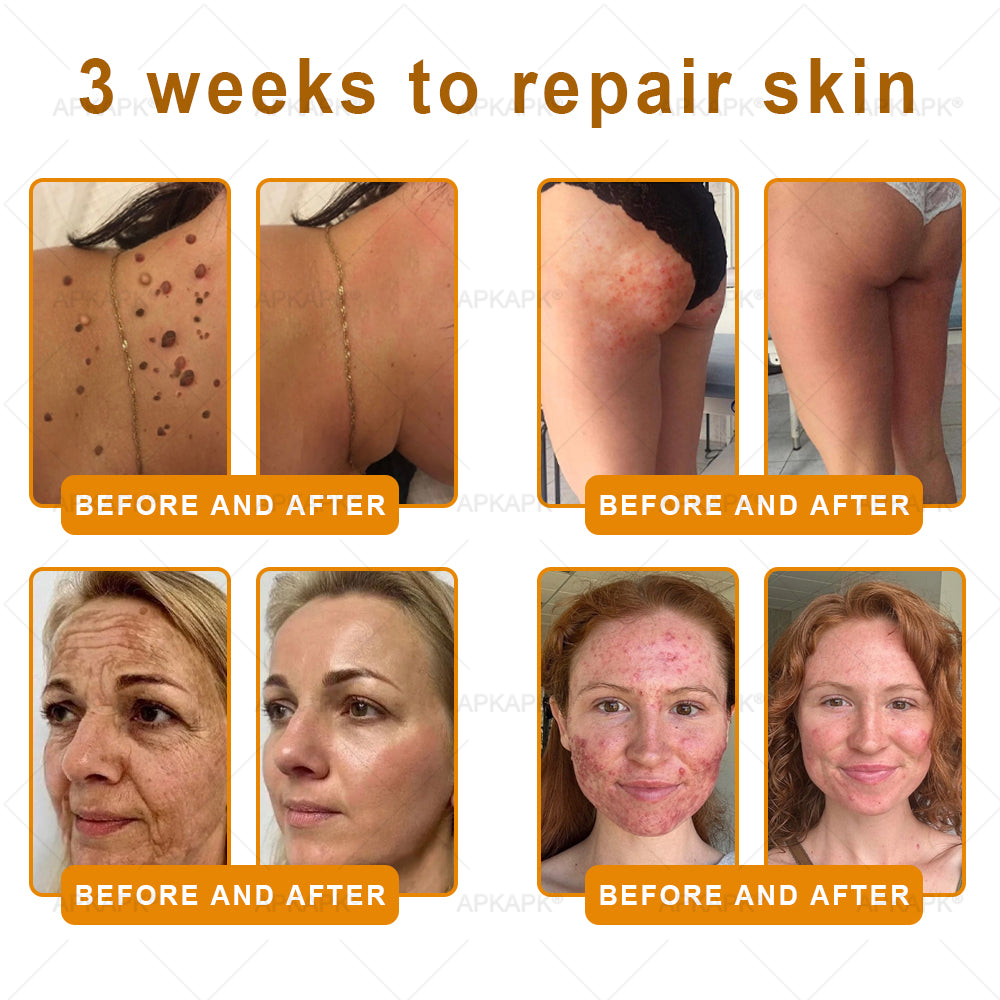 ODEIUN® 𝖡𝖾𝖾 𝗏𝖾𝗇𝗈𝗆 𝖲𝗄𝗂𝗇 𝖱𝖾𝗌𝗍𝗈𝗋𝖺𝗍𝗂𝗈𝗇 𝖢𝗋𝖾𝖺𝗆✨Made and Shipped from AU