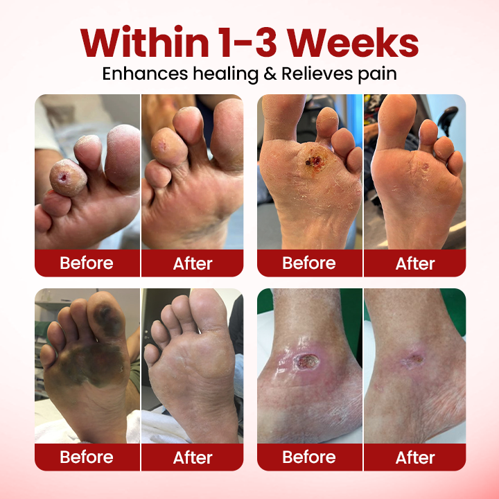 ODEIUN® VitaGluco Diabetic Care Cream