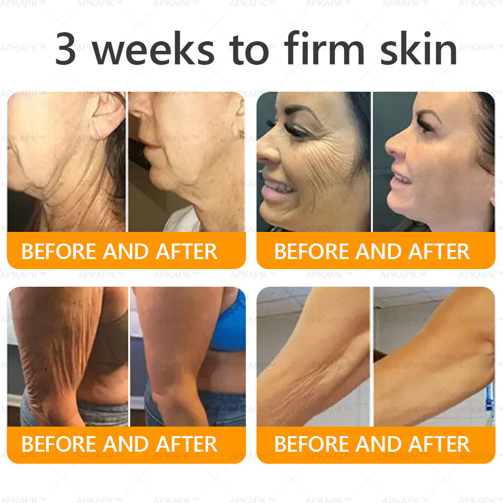 ODEIUN® 𝖡𝖾𝖾 𝗏𝖾𝗇𝗈𝗆 𝖲𝗄𝗂𝗇 𝖱𝖾𝗌𝗍𝗈𝗋𝖺𝗍𝗂𝗈𝗇 𝖢𝗋𝖾𝖺𝗆✨Made and Shipped from AU