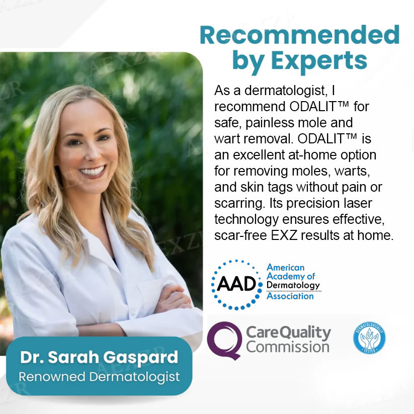 ODALIT™ Non-Invasive Mole and Wart Removal Laser Pen