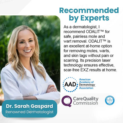 ODALIT™ Non-Invasive Mole and Wart Removal Laser Pen