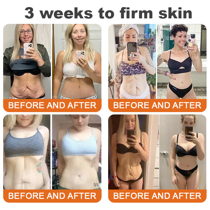 🐝💖Made and Shipped from USA✨Flysmus™ Botox Bee Venom Firming Serum Stick🔥LAST DAY 70% OFF