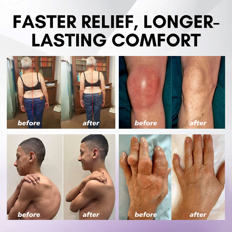 ODEIUN™ Turmeric & Emu Oil Arthritis Soothing Pain Relief Massage Gel 👨‍⚕️Australian Osteopathic Association （AOA）Approved