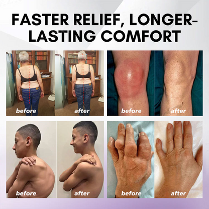 ODEIUN™ Turmeric & Emu Oil Arthritis Soothing Pain Relief Massage Gel 👨‍⚕️Australian Osteopathic Association （AOA）Approved