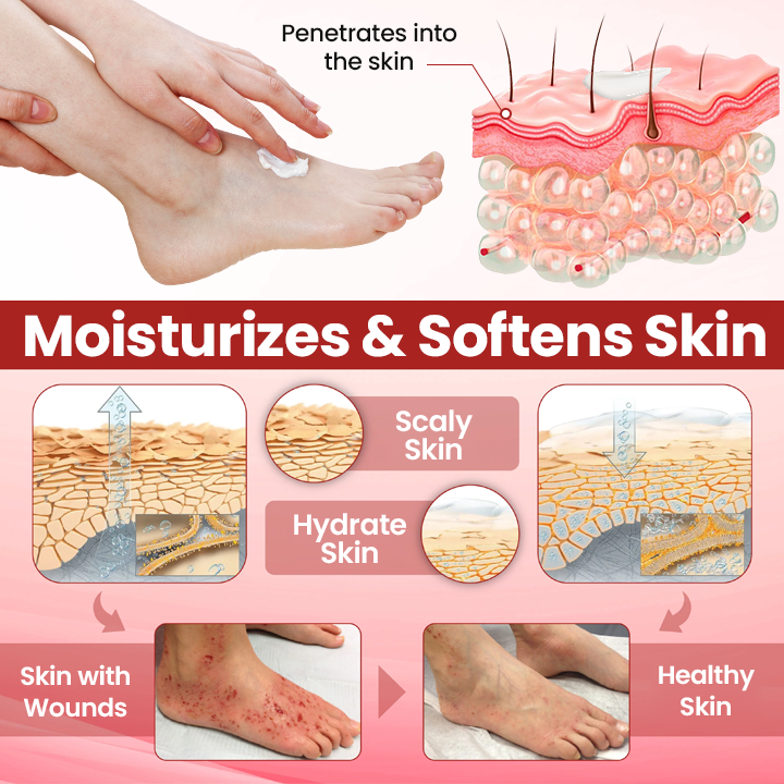 ODEIUN® VitaGluco Diabetic Care Cream