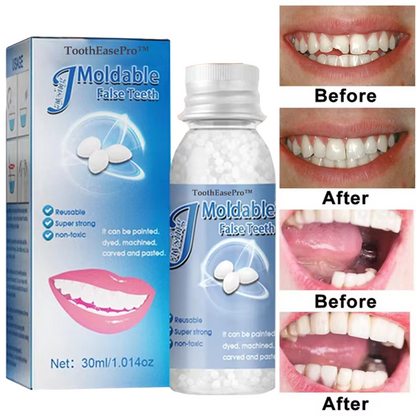 🦷 ToothEasePro™ Dental Filling Gel – Pain-Free, Drill-Free Cavity Solution💖💖