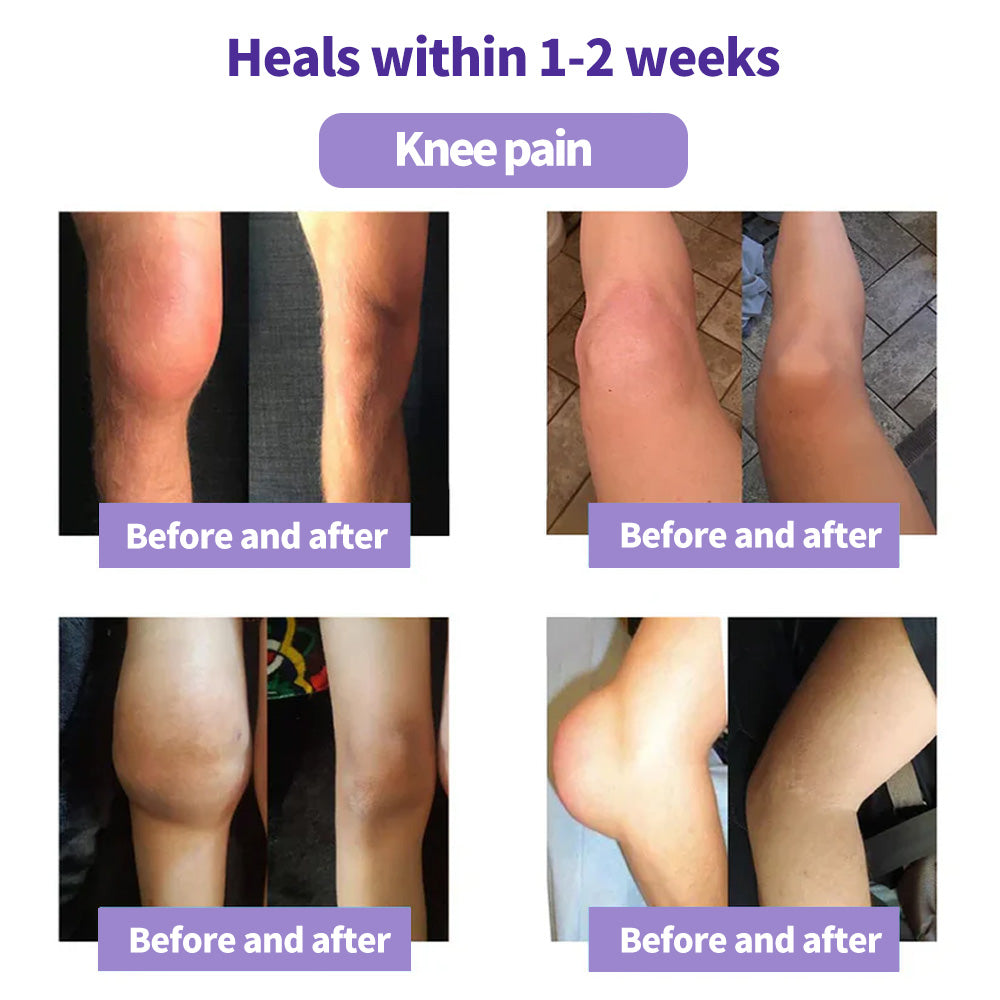 ODEIUN™ Turmeric & Emu Oil Arthritis Soothing Pain Relief Massage Gel 👨‍⚕️Australian Osteopathic Association （AOA）Approved