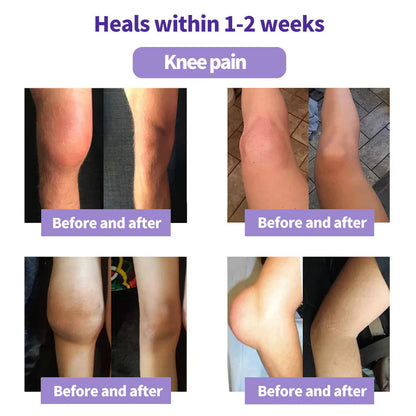 ODEIUN™ Turmeric & Emu Oil Arthritis Soothing Pain Relief Massage Gel 👨‍⚕️Australian Osteopathic Association （AOA）Approved