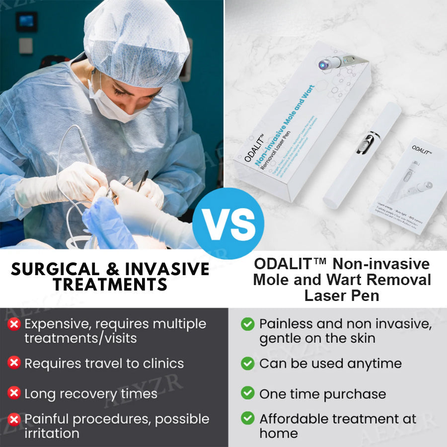 ODALIT™ Non-Invasive Mole and Wart Removal Laser Pen