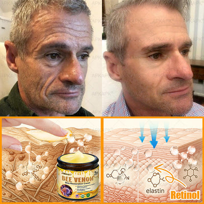 ODEIUN® 𝖡𝖾𝖾 𝗏𝖾𝗇𝗈𝗆 𝖲𝗄𝗂𝗇 𝖱𝖾𝗌𝗍𝗈𝗋𝖺𝗍𝗂𝗈𝗇 𝖢𝗋𝖾𝖺𝗆✨Made and Shipped from AU