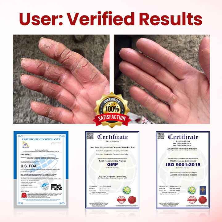 ODEIUN® VitaGluco Diabetic Care Cream