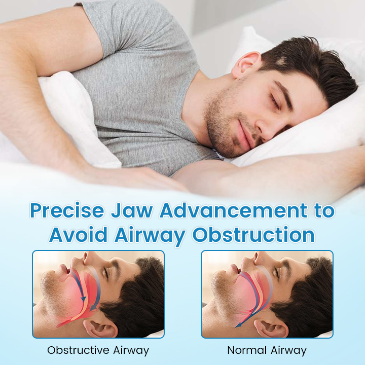 🔥[Official Brand Store] JEREMYTIS™ Adjustable Anti-Snoring Mouthpiece Universal Size