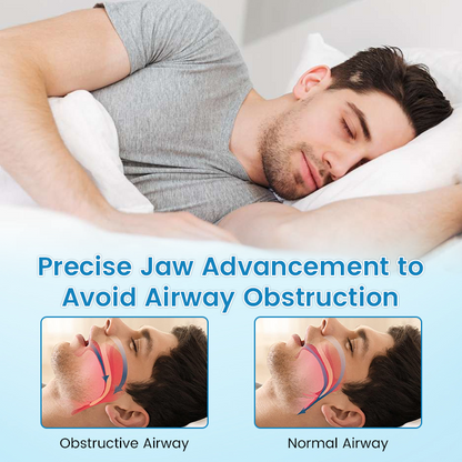 🔥[Official Brand Store] JEREMYTIS™ Adjustable Anti-Snoring Mouthpiece Universal Size
