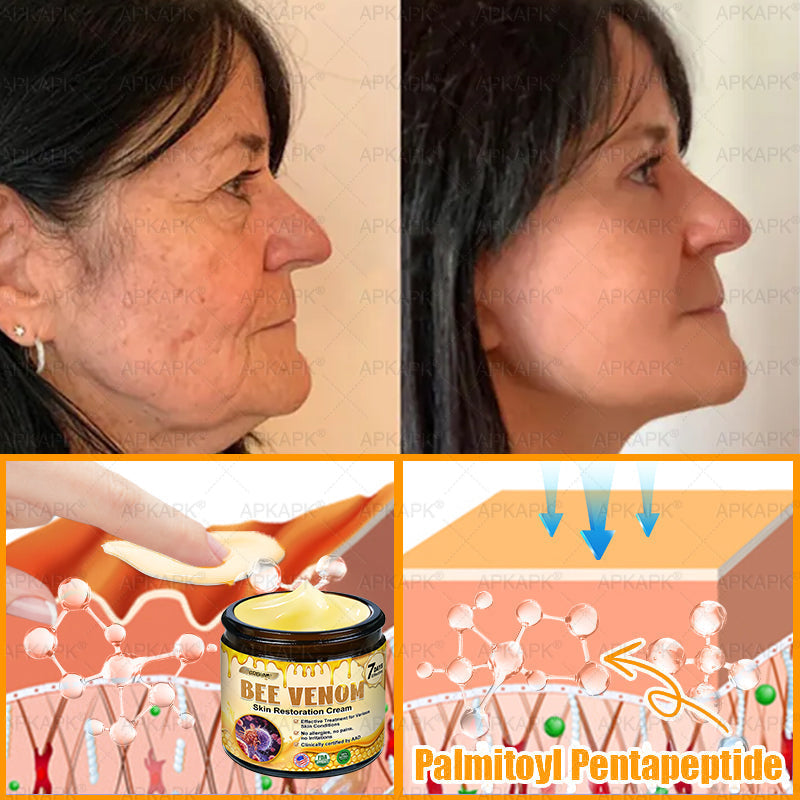 ODEIUN® 𝖡𝖾𝖾 𝗏𝖾𝗇𝗈𝗆 𝖲𝗄𝗂𝗇 𝖱𝖾𝗌𝗍𝗈𝗋𝖺𝗍𝗂𝗈𝗇 𝖢𝗋𝖾𝖺𝗆✨Made and Shipped from AU