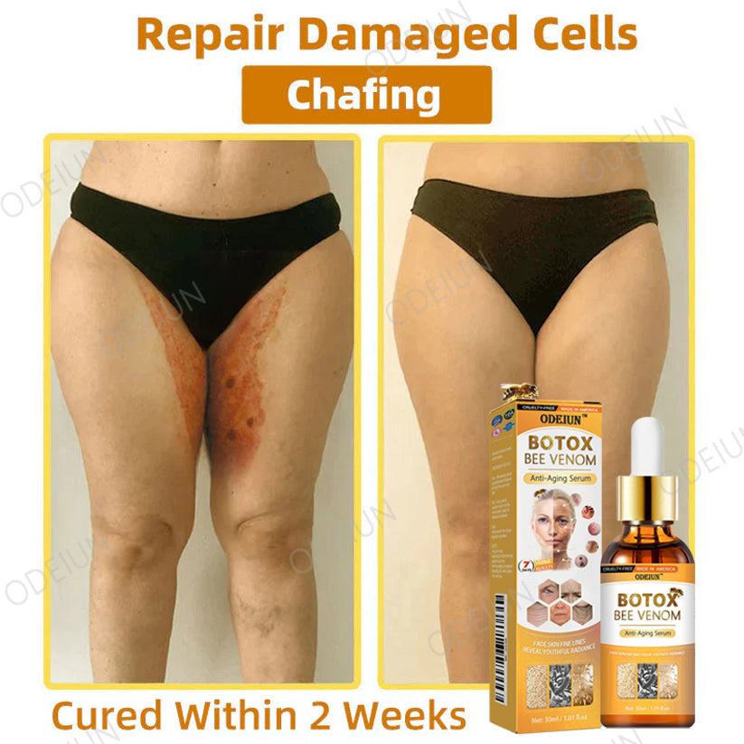 🎁Flash Sale - ODEIUN™ BOTOX Bee Venom Anti-Aging Serum - Suitable for all skin types🐝💎