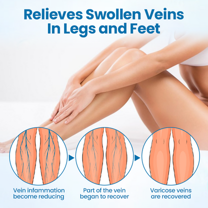 ODEIUN® VeinGuard Herbal Spray-✅ Clinically proven to eliminate varicose veins in just 7 days!