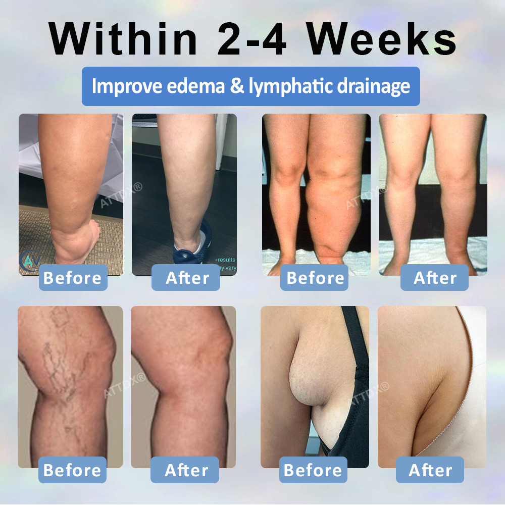 ODEIUN® Black Cumin Edema Detox Herbal Cream