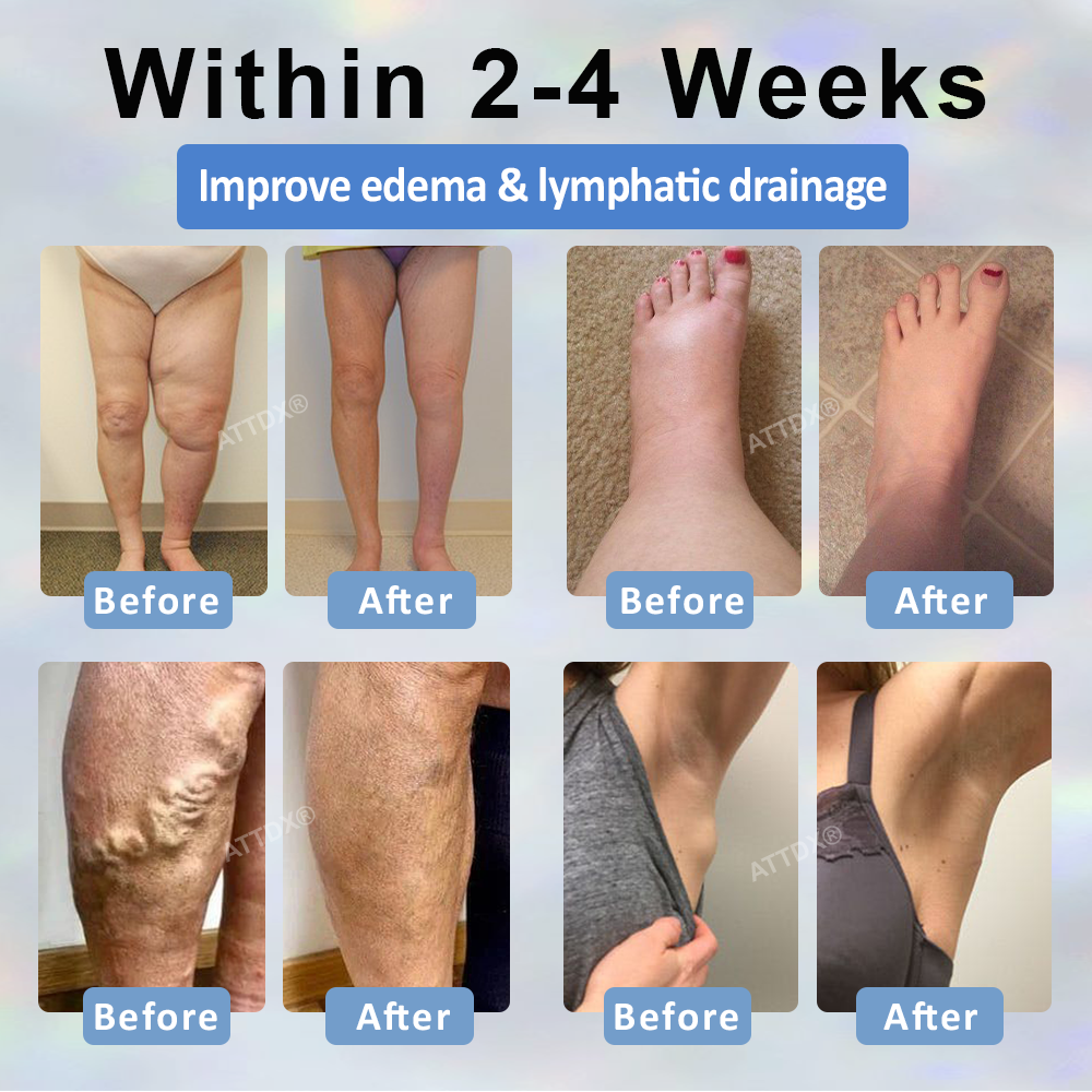 ODEIUN® Black Cumin Edema Detox Herbal Cream