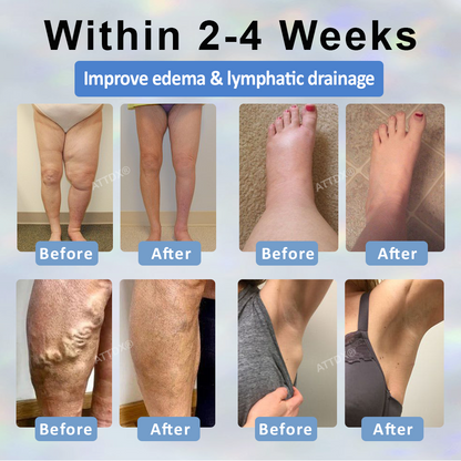 ODEIUN® Black Cumin Edema Detox Herbal Cream