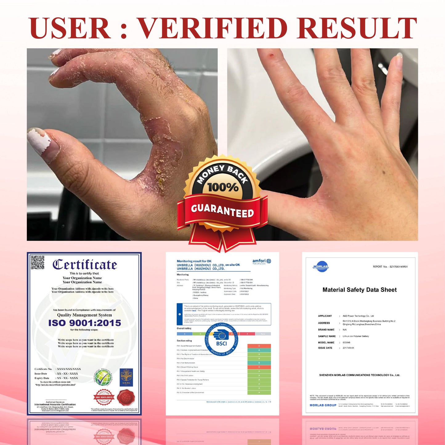 ATTDX® GlucoseGuard Skin Rescue Cream