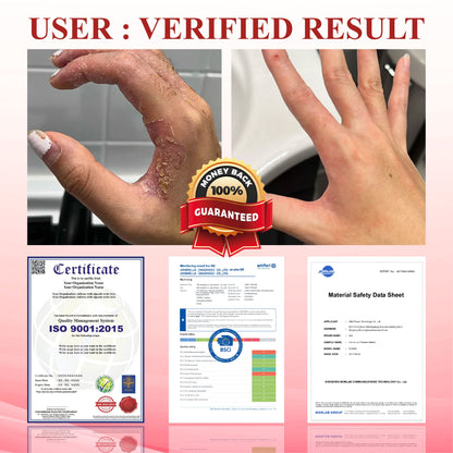 ATTDX® GlucoseGuard Skin Rescue Cream