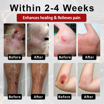 ATTDX® GlucoseGuard Skin Rescue Cream