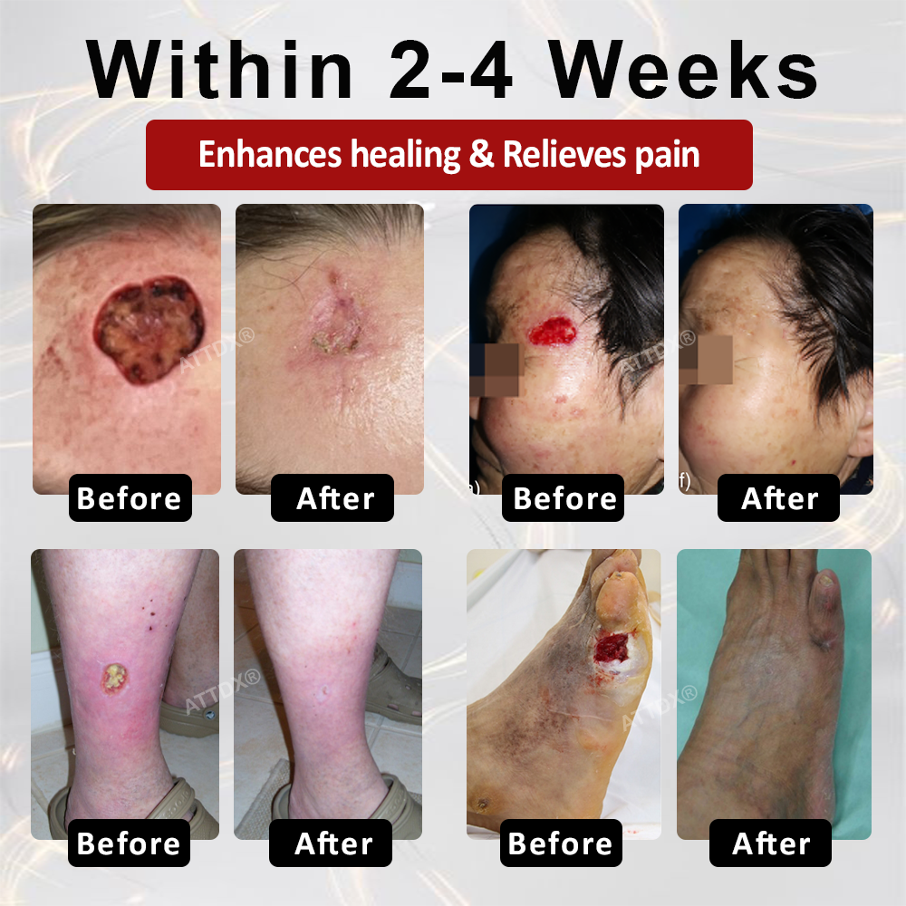 ATTDX® GlucoseGuard Skin Rescue Cream