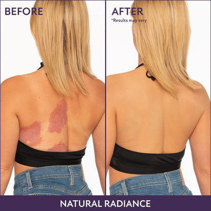 🎁Last Day - Buy 1 Get 1 Free🎉All-in-one Moisturizer, Concealer & Coverage 💧✨ Lightweight & Waterproof