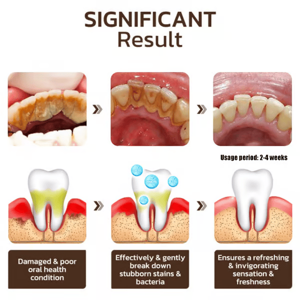 ✨ Achieve a Radiant Smile - 49% OFF - 🦷 Niacinamide Whitening Toothpaste - For Healthier, Whiter Teeth!