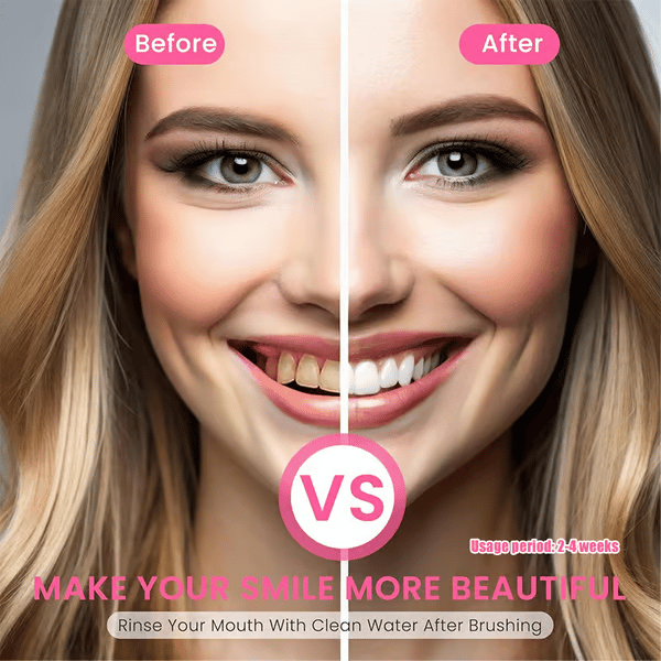 ✨ Achieve a Radiant Smile - 49% OFF - 🦷 Niacinamide Whitening Toothpaste - For Healthier, Whiter Teeth!