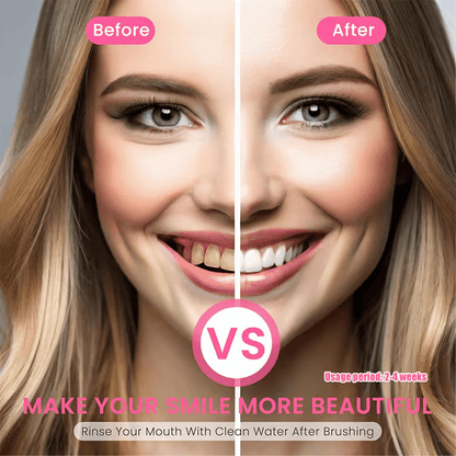 ✨ Achieve a Radiant Smile - 49% OFF - 🦷 Niacinamide Whitening Toothpaste - For Healthier, Whiter Teeth!